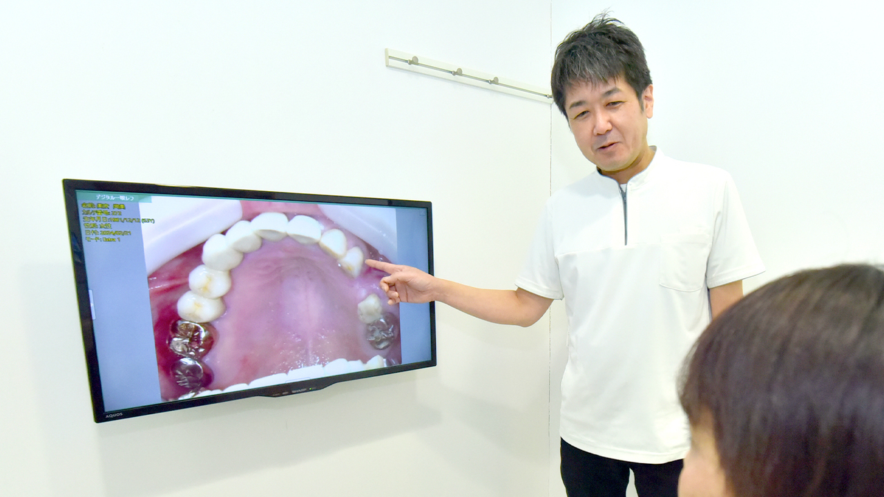 枚方市のラミネートべニア