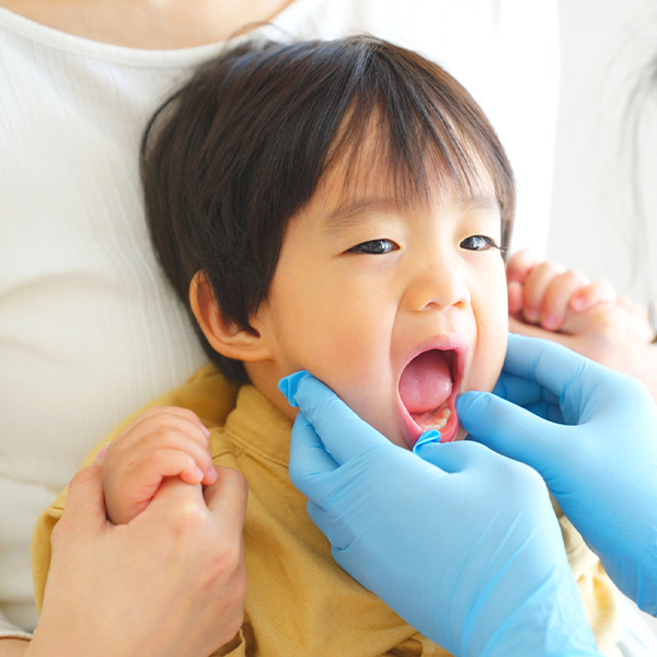 枚方市の小児の予防歯科