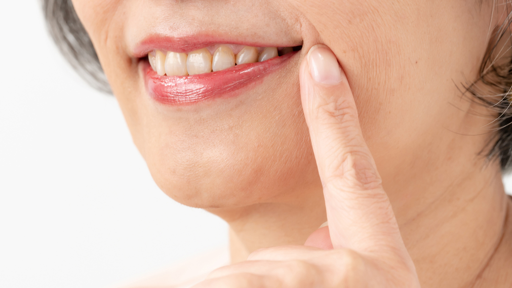 枚方市のインプラントオーバーデンチャー