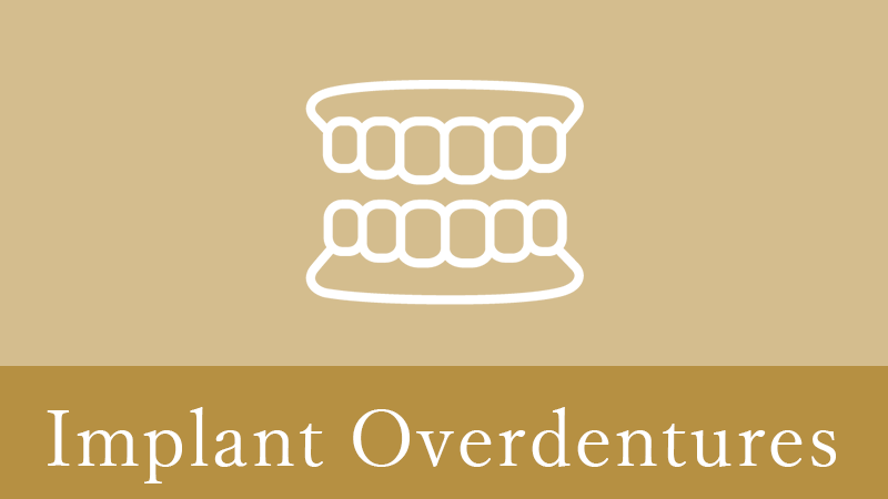 枚方市のインプラントオーバーデンチャー