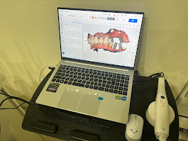枚方市のインプラントのこだわり