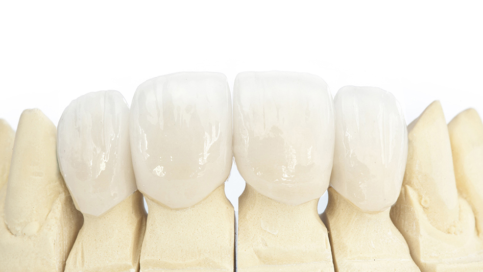 枚方市の審美歯科