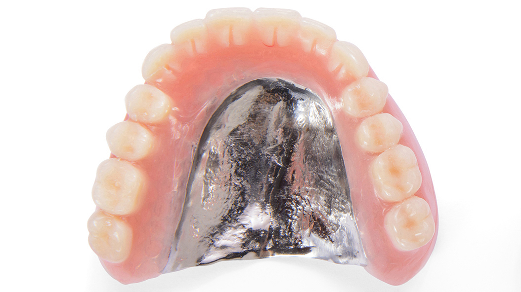 枚方市の金属床義歯