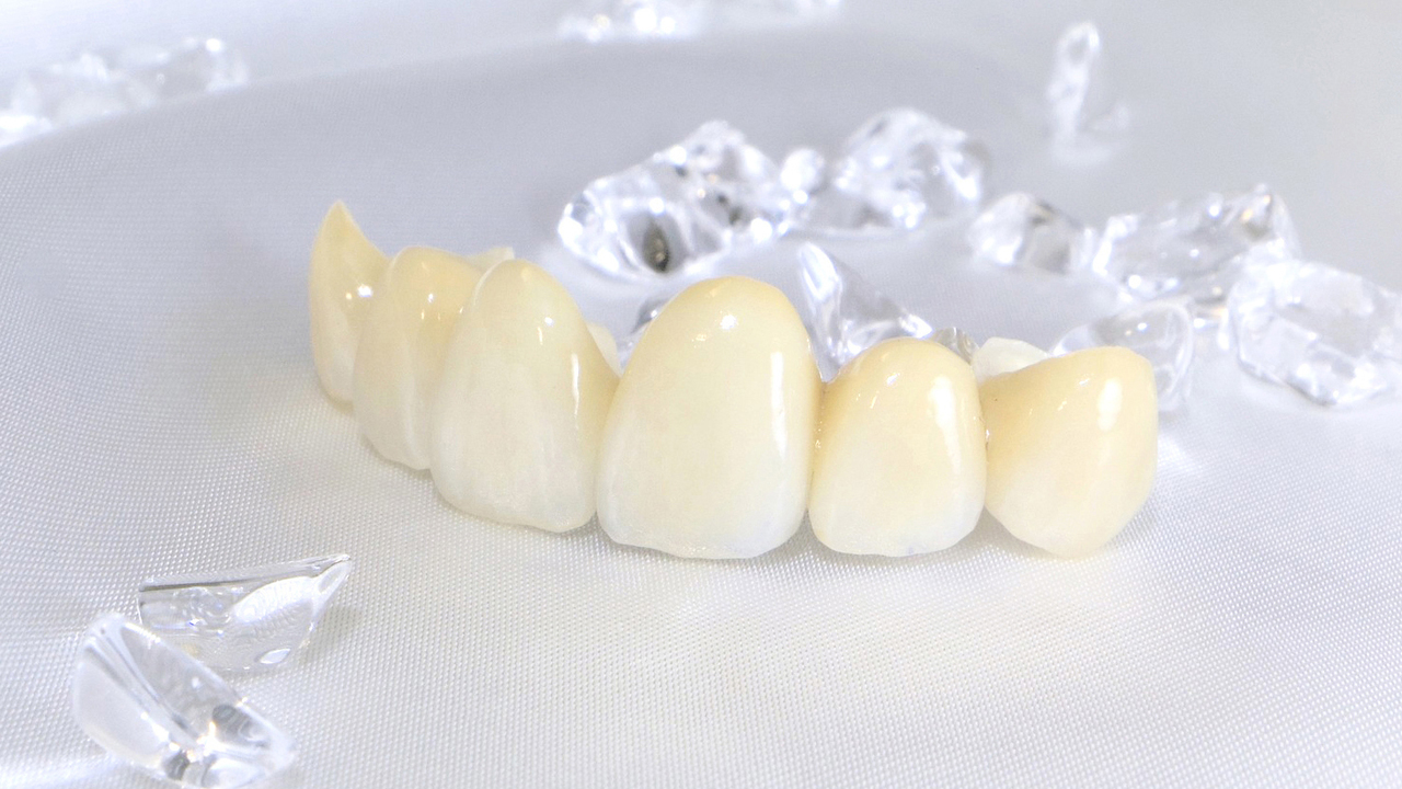 枚方市のセラミック治療