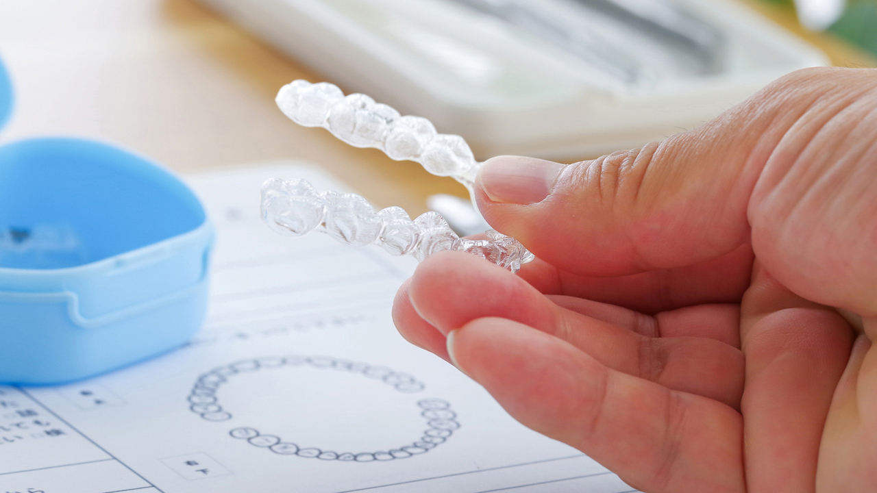 枚方市の歯ぎしりの治療（ナイトガード）