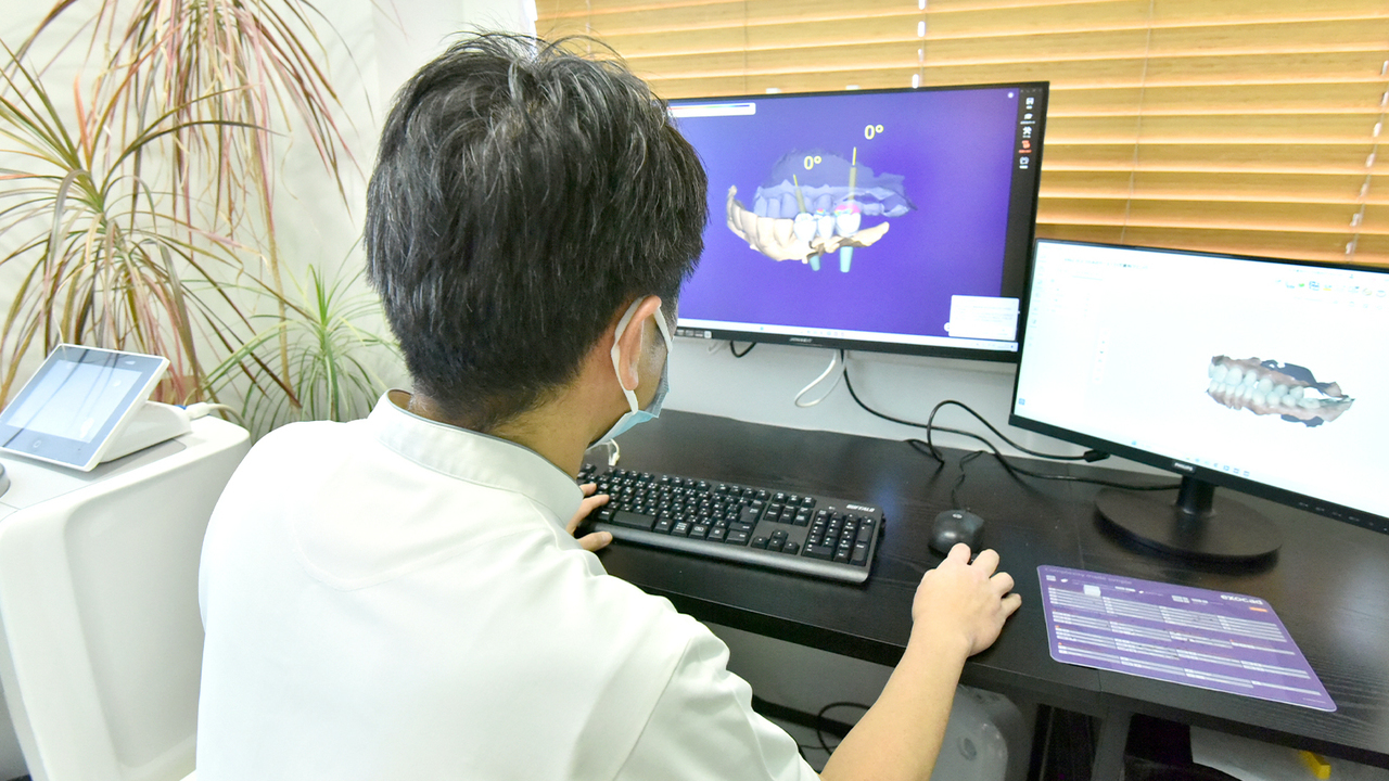枚方市のCTを含めたインプラントに必要な医療機器