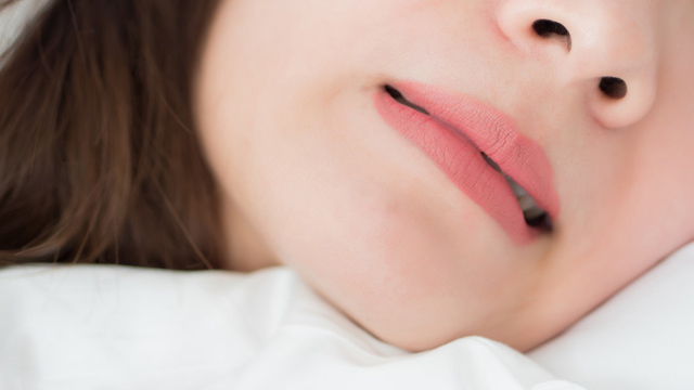 枚方市の歯ぎしりの治療（ナイトガード）