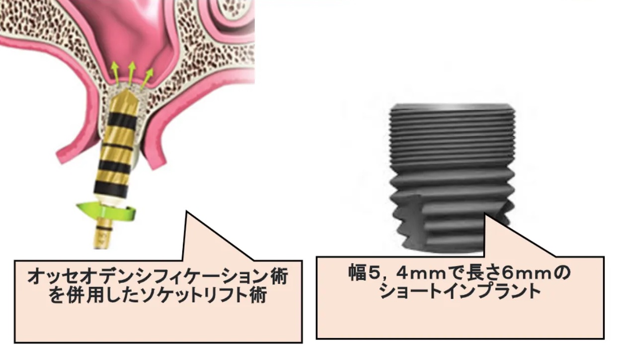 丁寧な継続コンサルティング